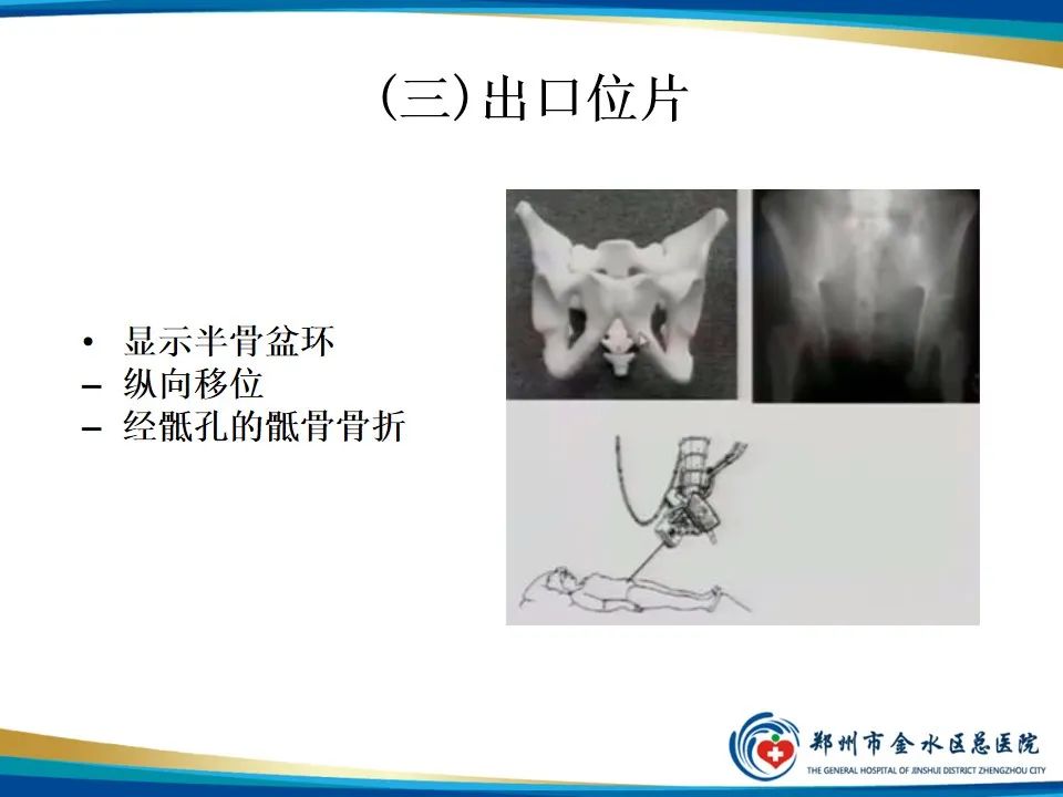【PPT】骨盆拍片技术与临床意义-14