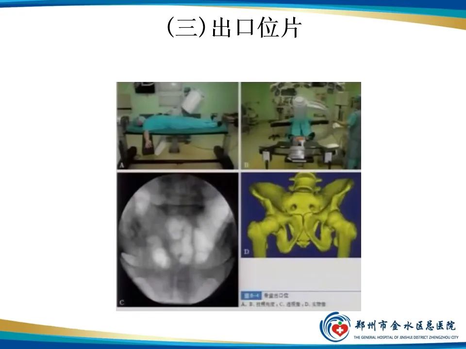 【PPT】骨盆拍片技术与临床意义-15