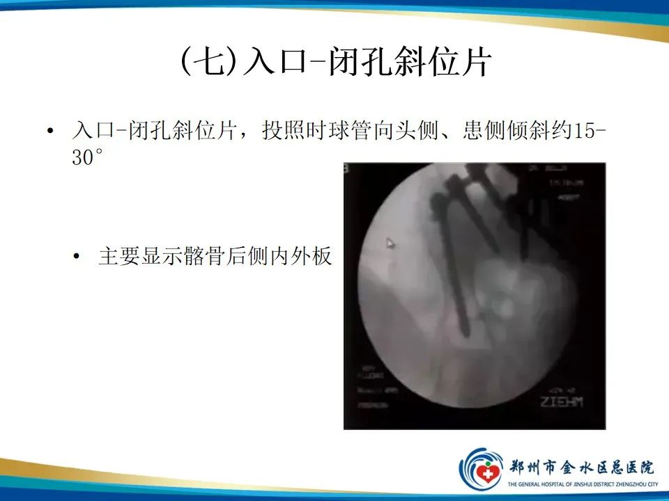 【PPT】骨盆拍片技术与临床意义-26