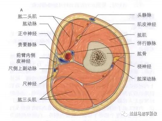 锁骨下和上肢动脉的解剖-4