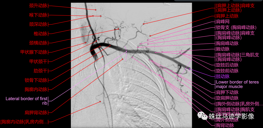 锁骨下和上肢动脉的解剖-10