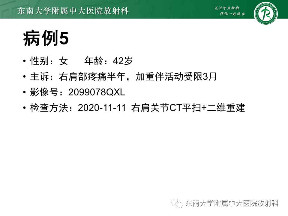 【PPT】骨纤维异常增殖症-23