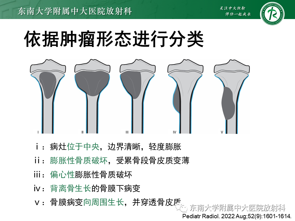 【PPT】骨纤维异常增殖症-31