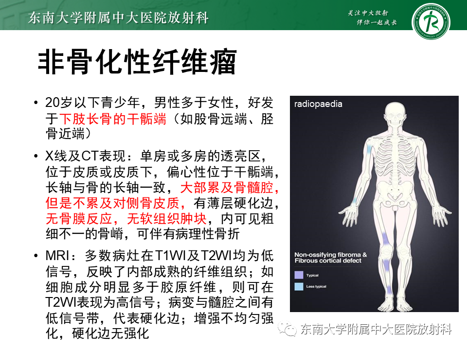 【PPT】骨纤维异常增殖症-40