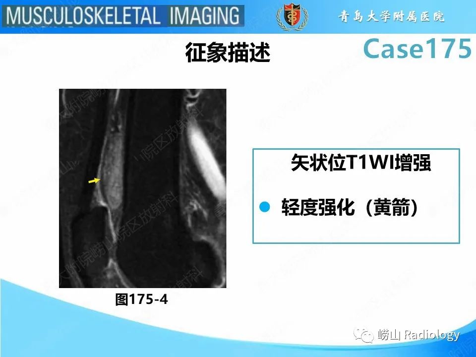【PPT】局灶性结节性滑膜炎-28