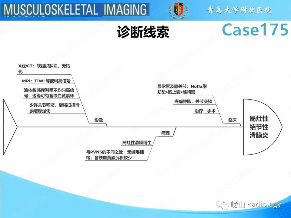 【PPT】局灶性结节性滑膜炎-29