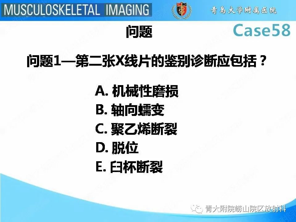 【PPT】髋关节手术并发症-3