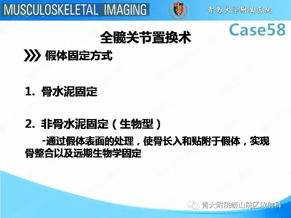 【PPT】髋关节手术并发症-7