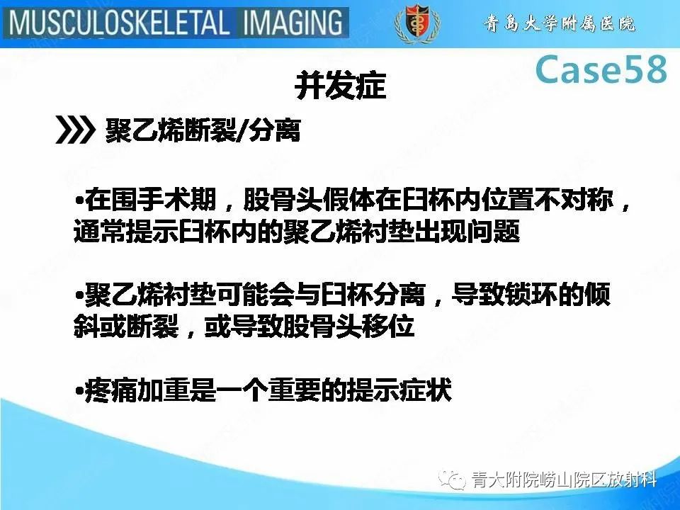 【PPT】髋关节手术并发症-9