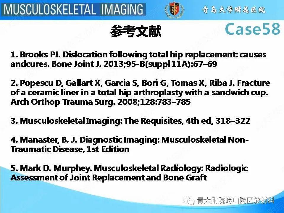 【PPT】髋关节手术并发症-31