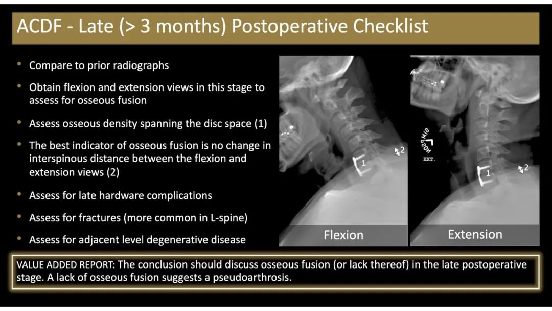 【PPT】评估围手术期脊柱:除了退行性椎间盘疾病和金属植入物的并发症外-7 【PPT】评估围手术期脊柱:除了退行性椎间盘疾病和金属植入物的并发症外-7
