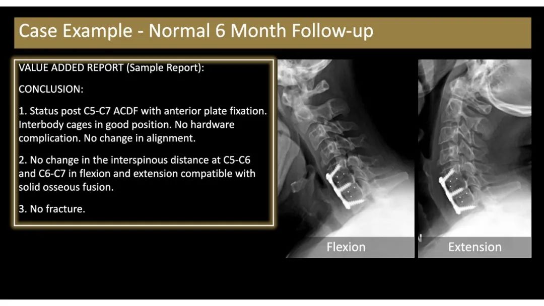 【PPT】评估围手术期脊柱:除了退行性椎间盘疾病和金属植入物的并发症外-9 【PPT】评估围手术期脊柱:除了退行性椎间盘疾病和金属植入物的并发症外-9