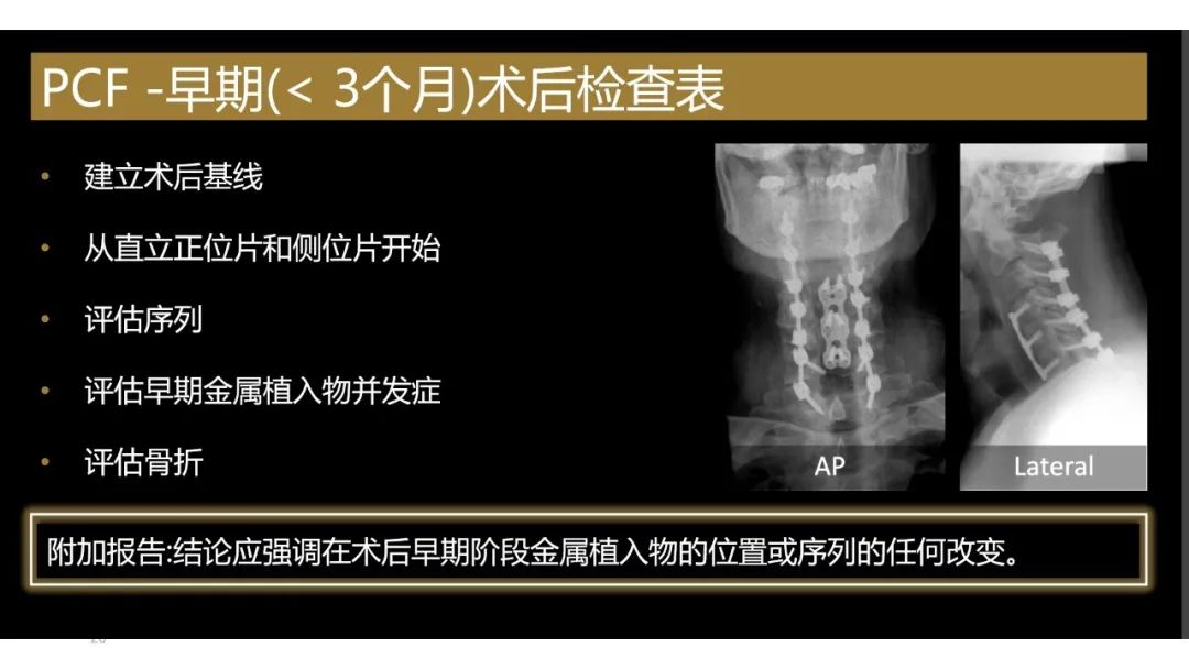【PPT】评估围手术期脊柱:除了退行性椎间盘疾病和金属植入物的并发症外-20 【PPT】评估围手术期脊柱:除了退行性椎间盘疾病和金属植入物的并发症外-20