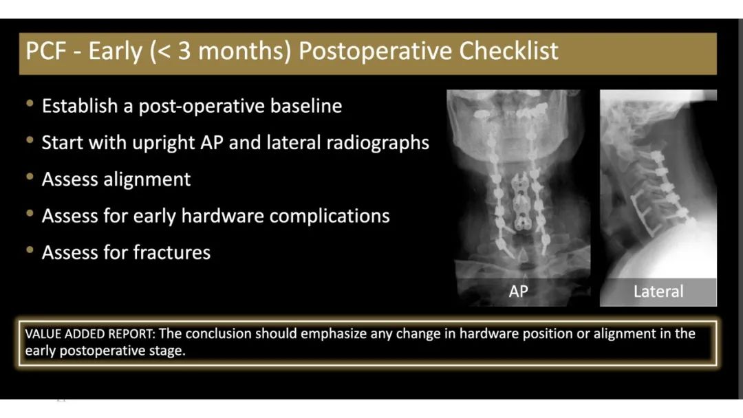 【PPT】评估围手术期脊柱:除了退行性椎间盘疾病和金属植入物的并发症外-21 【PPT】评估围手术期脊柱:除了退行性椎间盘疾病和金属植入物的并发症外-21
