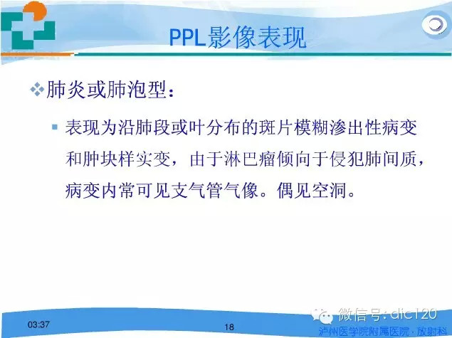 肺淋巴瘤的影像诊断