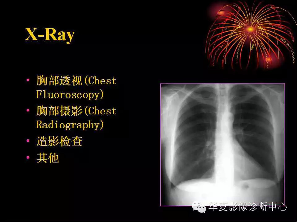 肺与纵隔的影像诊断
