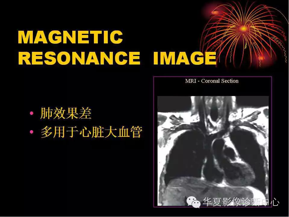 肺与纵隔的影像诊断