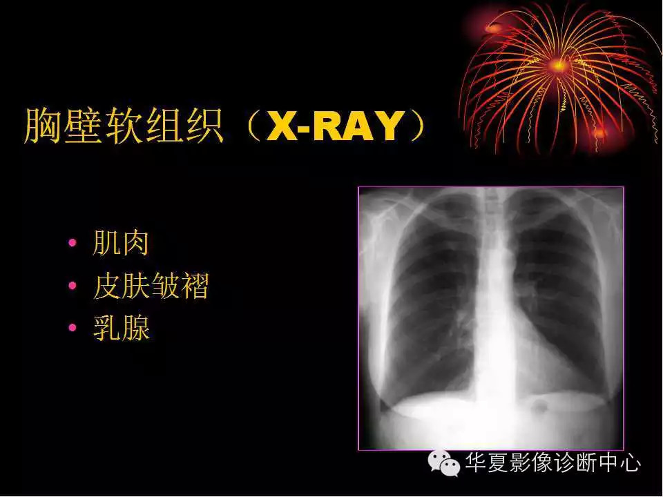 肺与纵隔的影像诊断