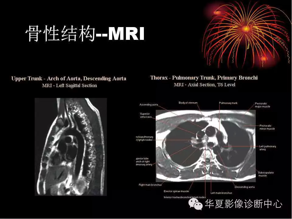肺与纵隔的影像诊断