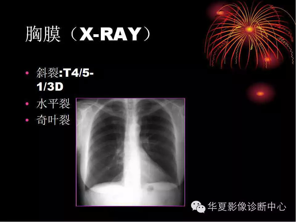 肺与纵隔的影像诊断