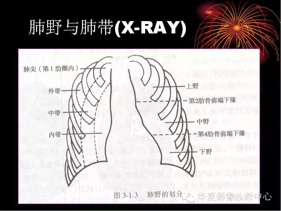肺与纵隔的影像诊断