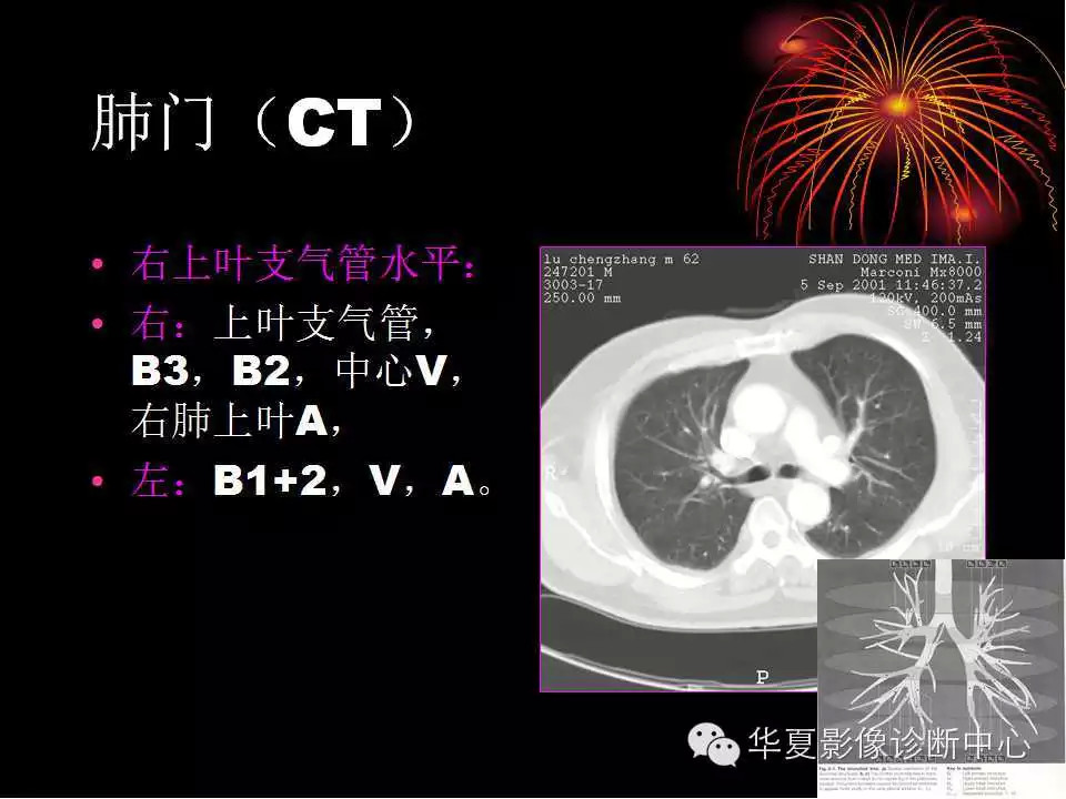 肺与纵隔的影像诊断