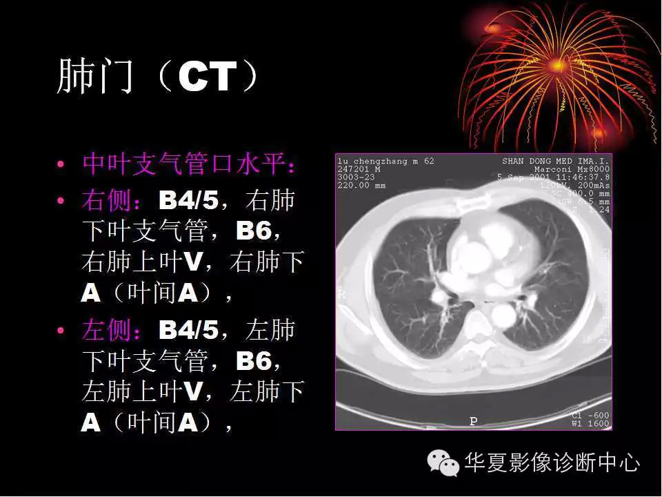 肺与纵隔的影像诊断