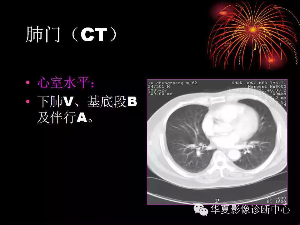 肺与纵隔的影像诊断