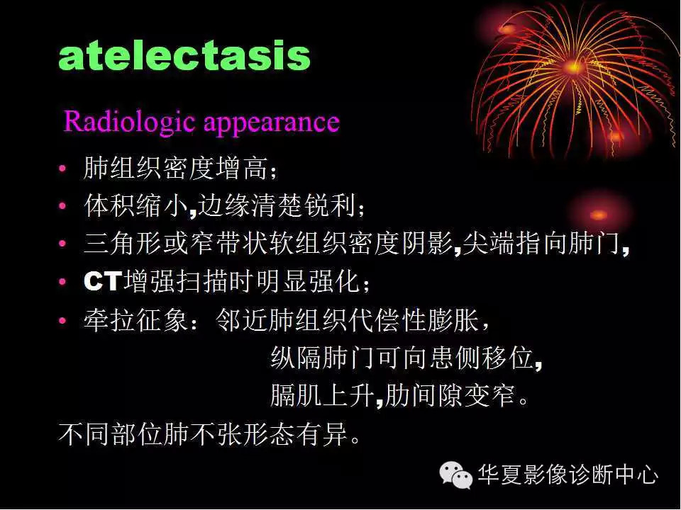 肺与纵隔的影像诊断