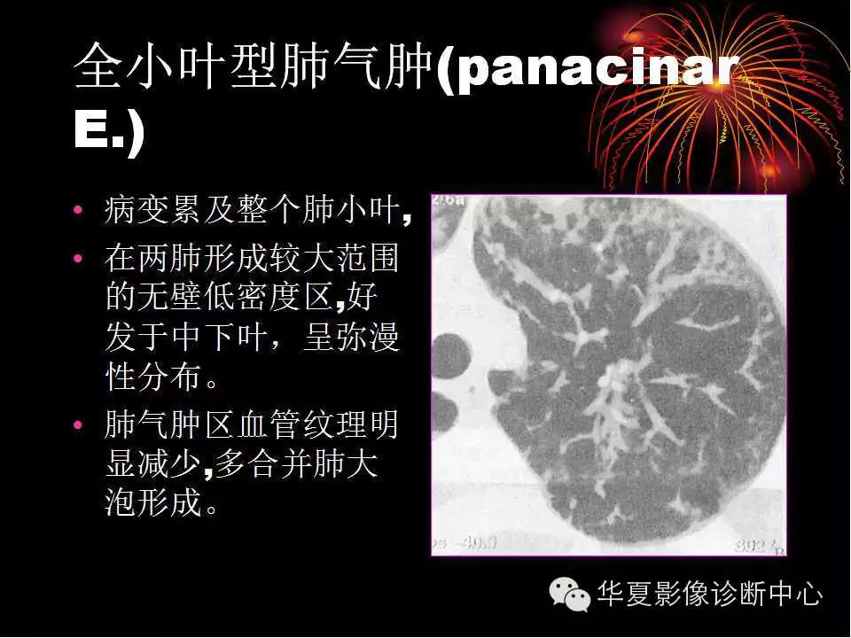 肺与纵隔的影像诊断