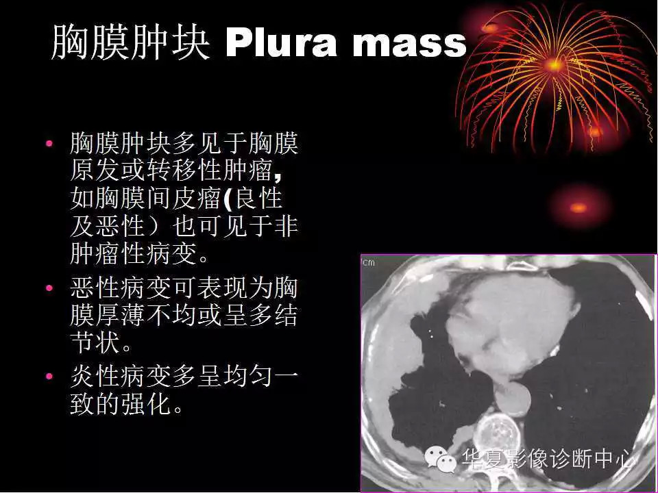 肺与纵隔的影像诊断