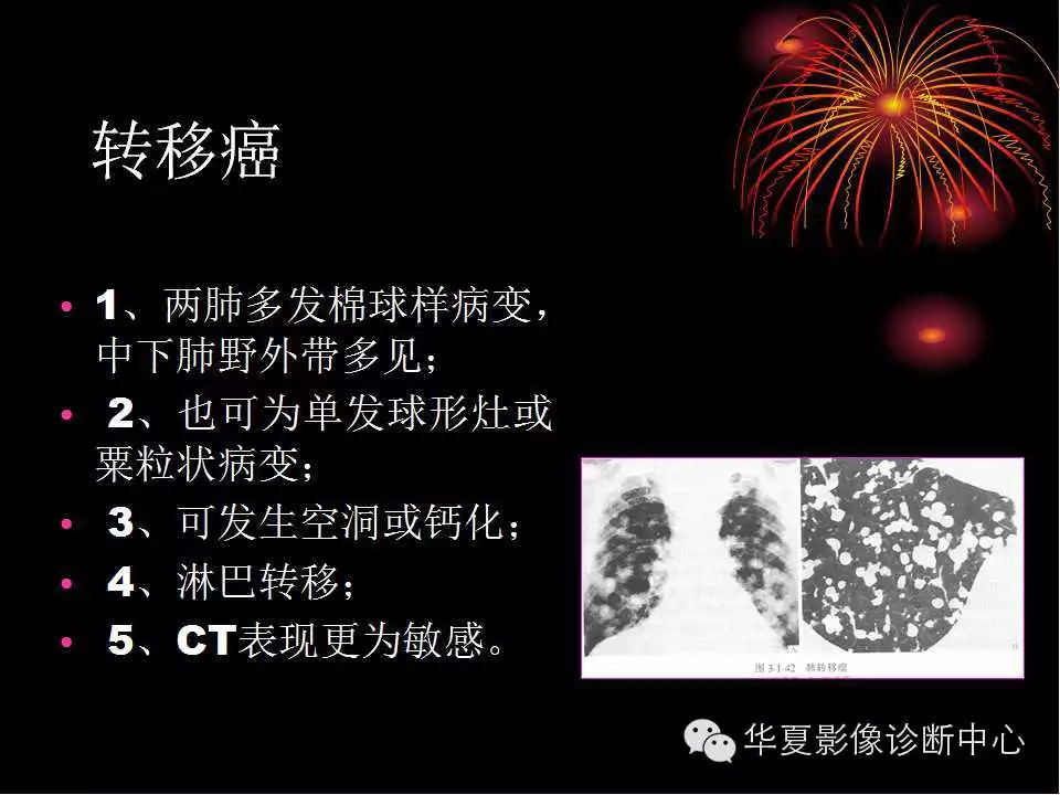 肺与纵隔的影像诊断