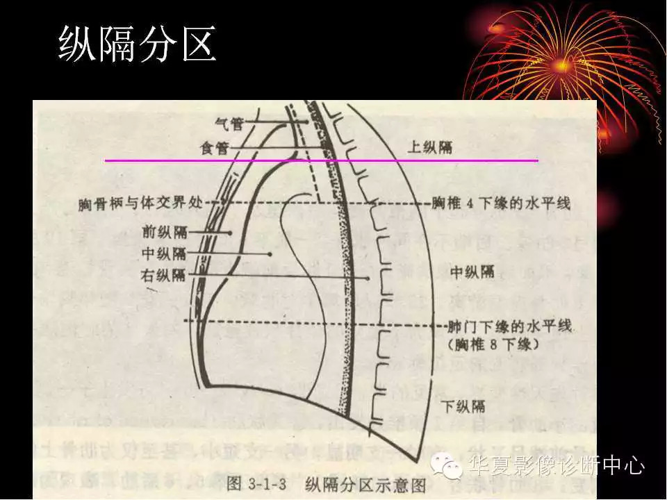 肺与纵隔的影像诊断
