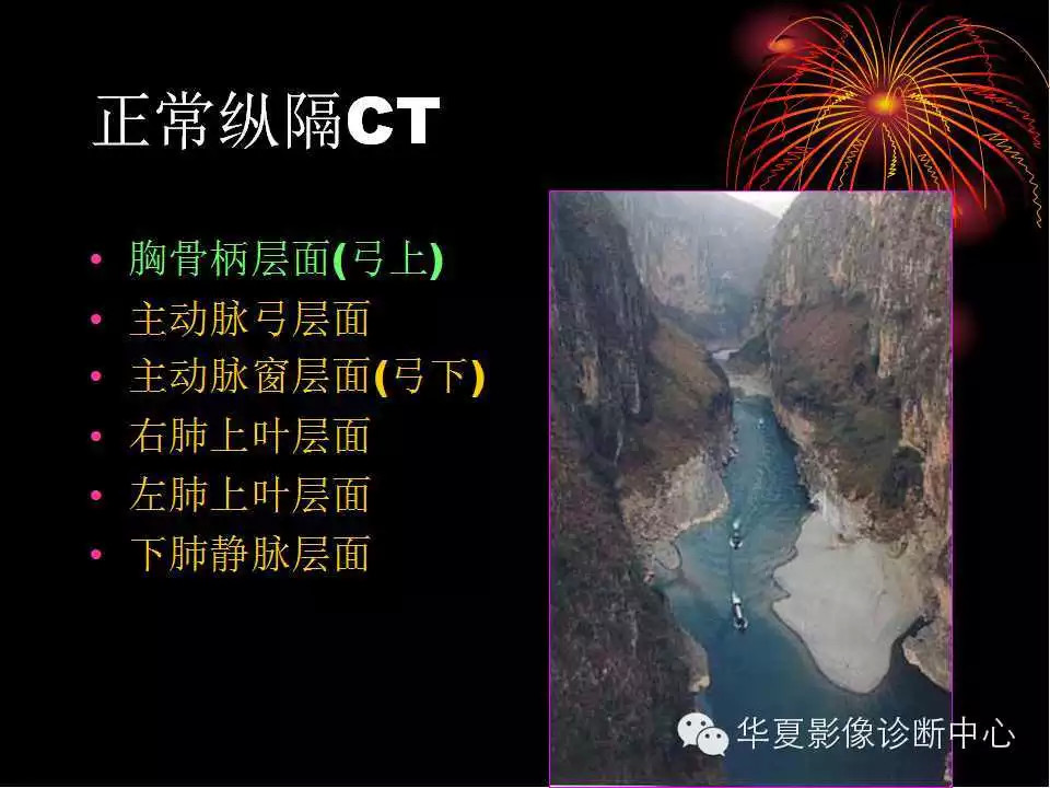 肺与纵隔的影像诊断