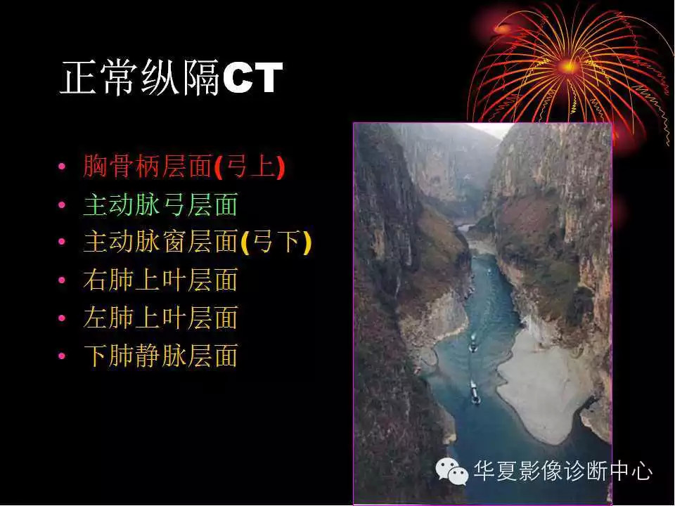 肺与纵隔的影像诊断