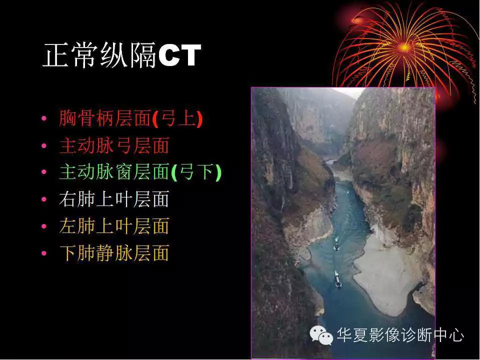 肺与纵隔的影像诊断