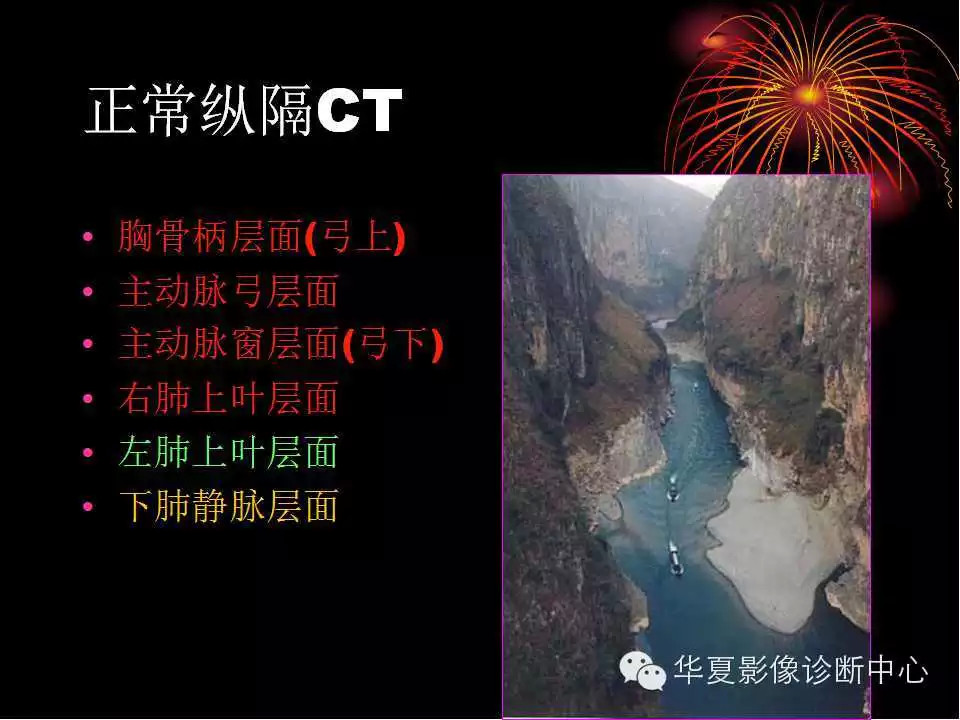 肺与纵隔的影像诊断