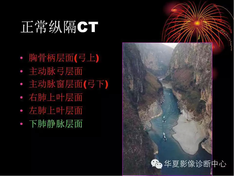 肺与纵隔的影像诊断