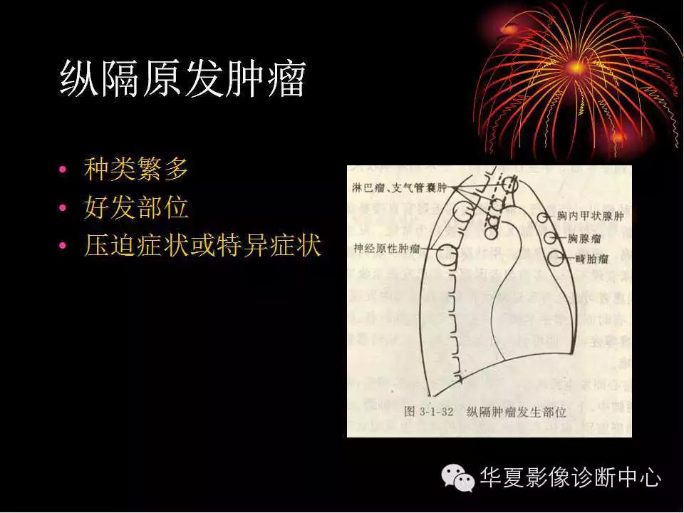 肺与纵隔的影像诊断