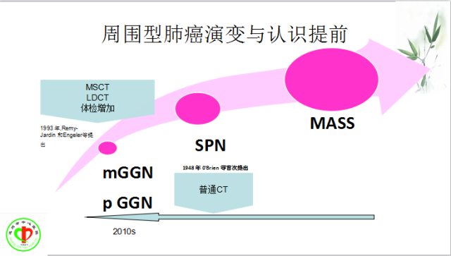 肺部微小结节再认识