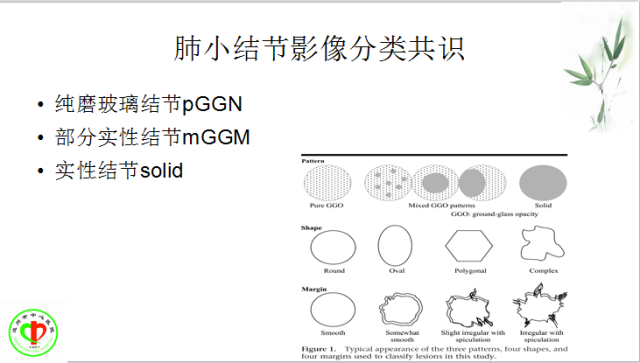 肺部微小结节再认识