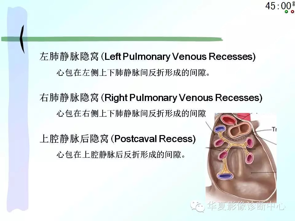 心包隐窝、心包窦的解剖