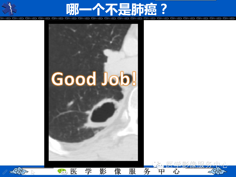 【考考你】哪一个不是肺癌？（共12组病例）