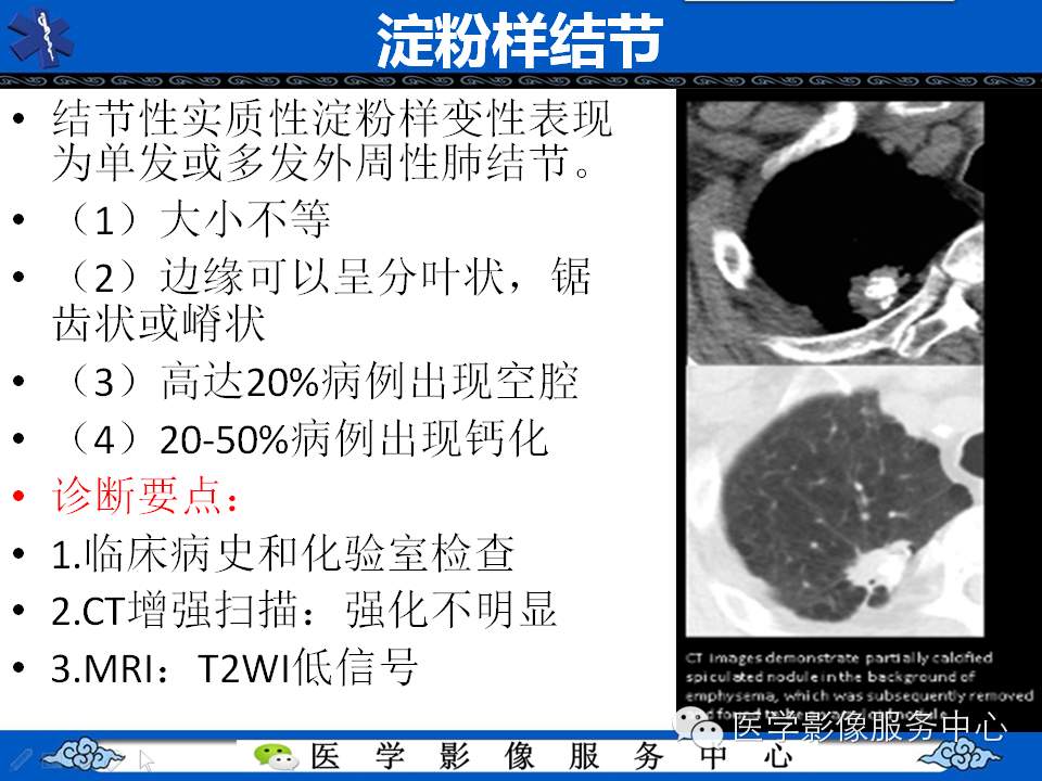 【考考你】哪一个不是肺癌？（共12组病例）