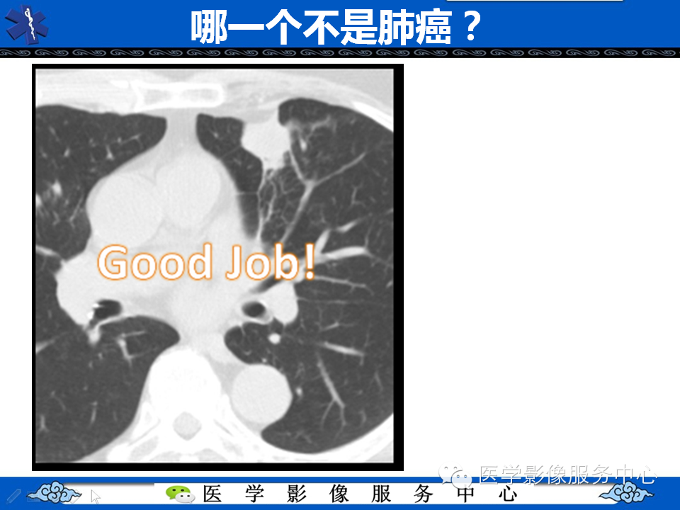 【考考你】哪一个不是肺癌？（共12组病例）