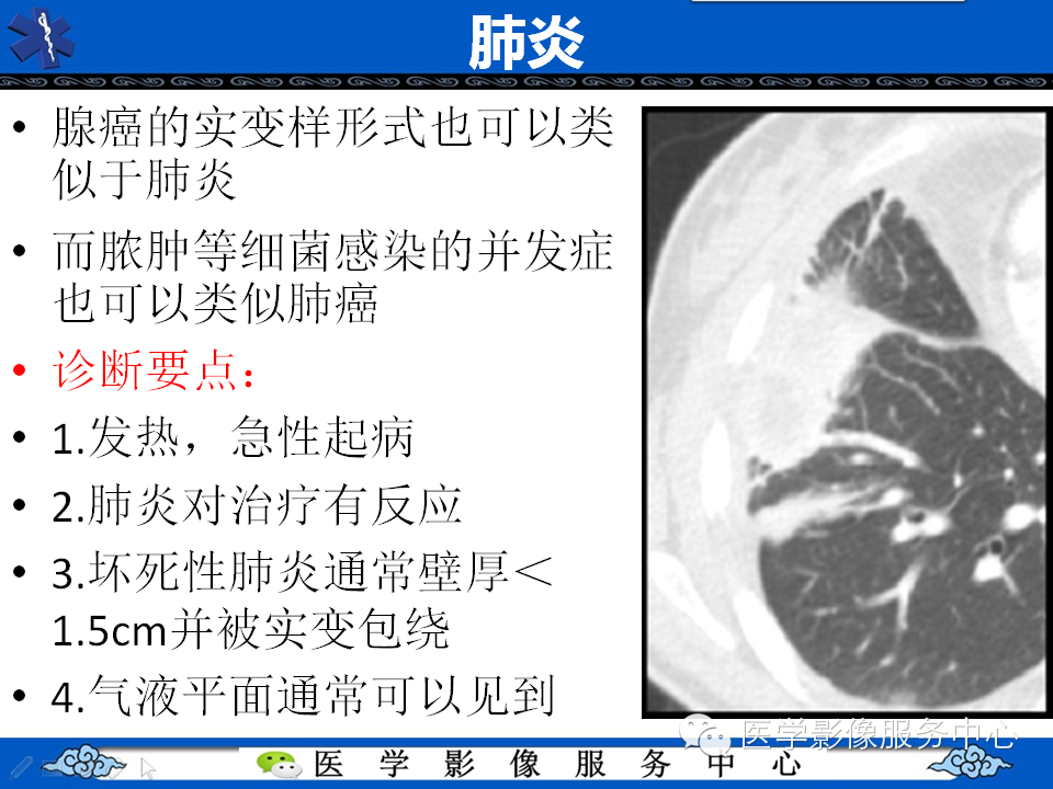【考考你】哪一个不是肺癌？（共12组病例）