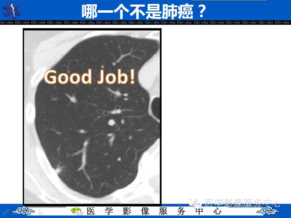 【考考你】哪一个不是肺癌？（共12组病例）