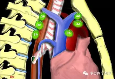胸内（纵膈）淋巴结分区
