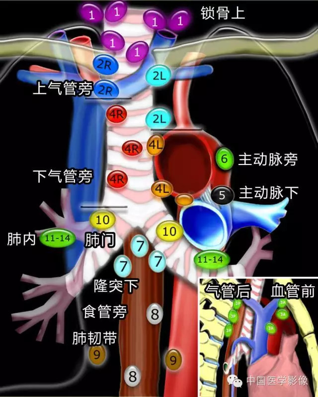 胸内（纵膈）淋巴结分区