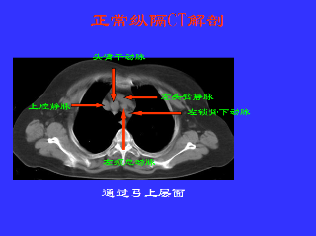 胸部CT阅读与诊断